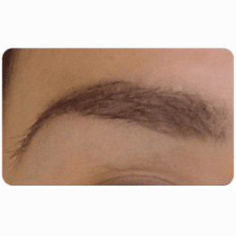 eyebrow transplant eyebrow transplant
