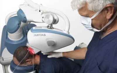 What is an Automated FUE Machine?