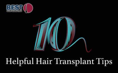 10 Helpful Tips to Find the Best Hair Transplant in California