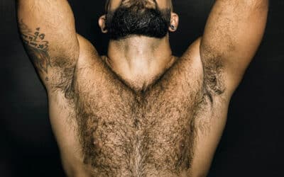 How Does a Body Hair Transplant to Scalp Work?