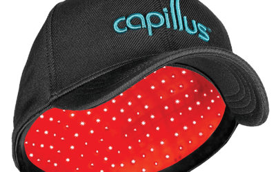 5 Common Questions About Capillus