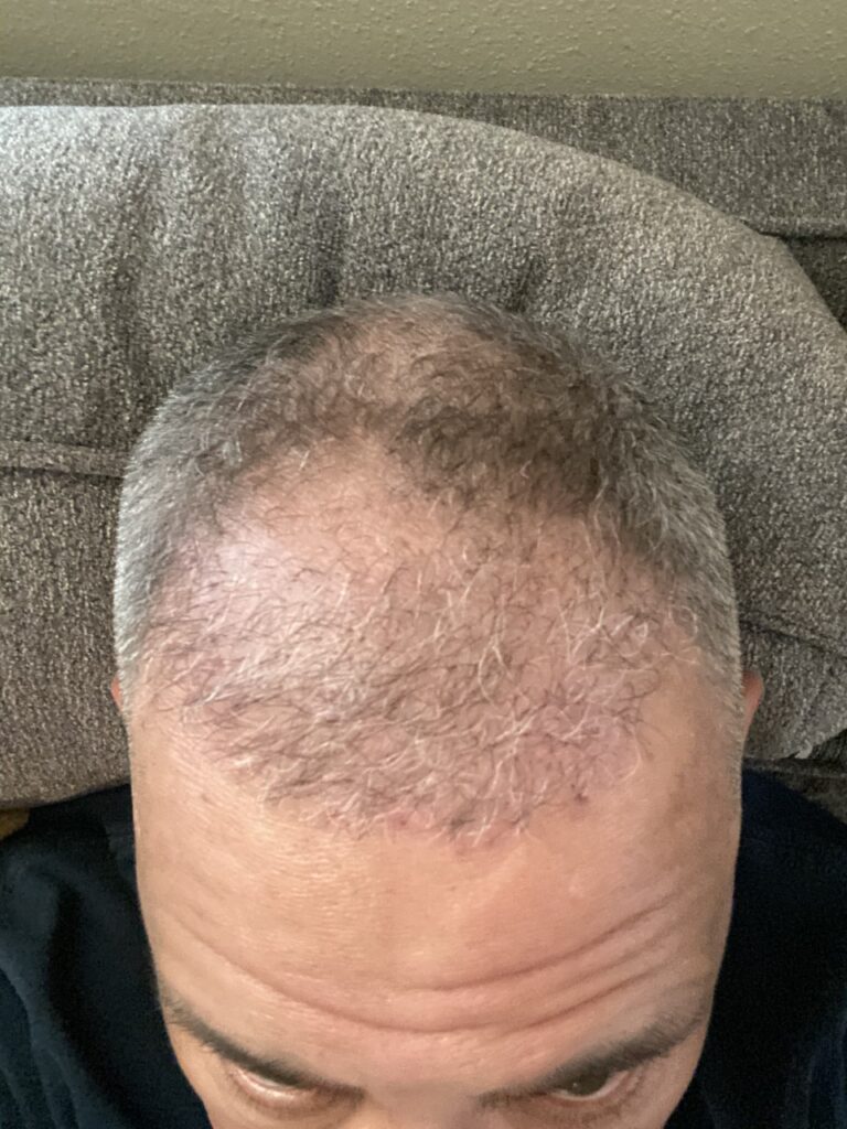 Hair Before