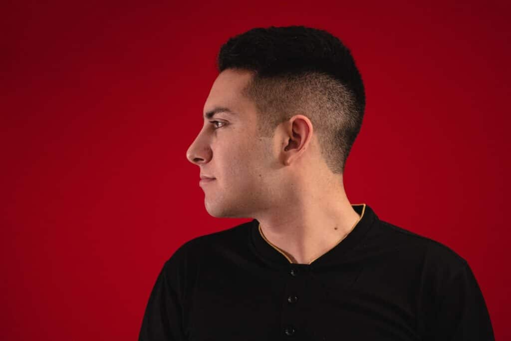 South Bay hair transplants
