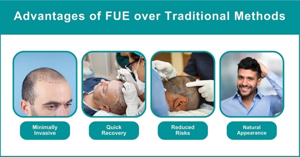 Advantages of FUE over Traditional Methods