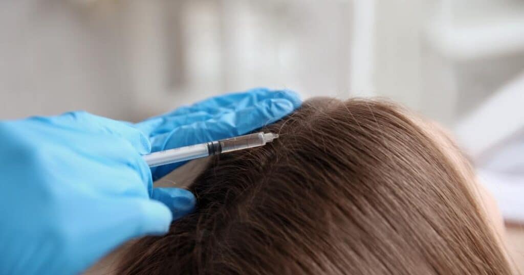 What You Need to Know About Woman's Hair Transplant Surgery