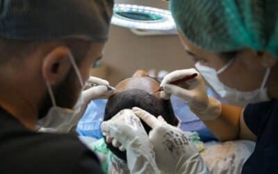 What to Know About FUE 3000 Grafts Hair Transplant Cost