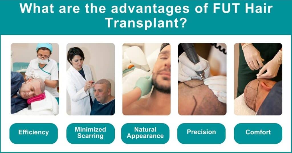 What are the advantages of FUT Hair Transplant