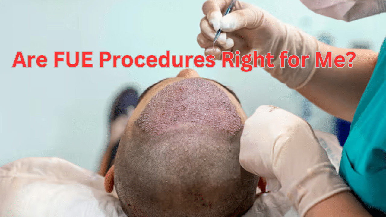 Are FUE Procedures Right for Me?