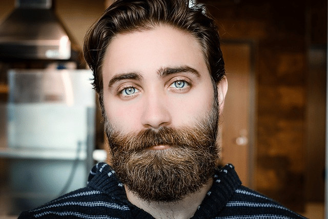 Patchy beard progress improves over time