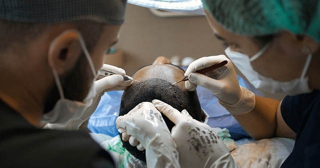 African American FUE hair transplant patient during hair restoration surgery