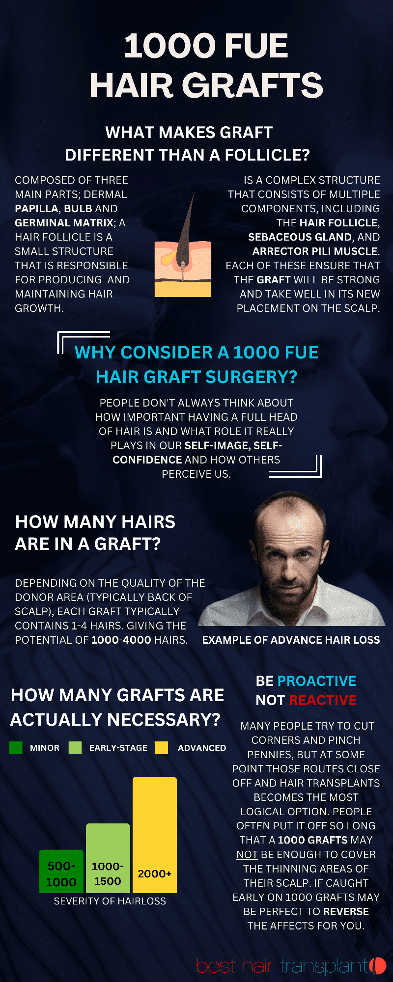 1000 FUE hair grafts - What makes a graft different than a follicle?