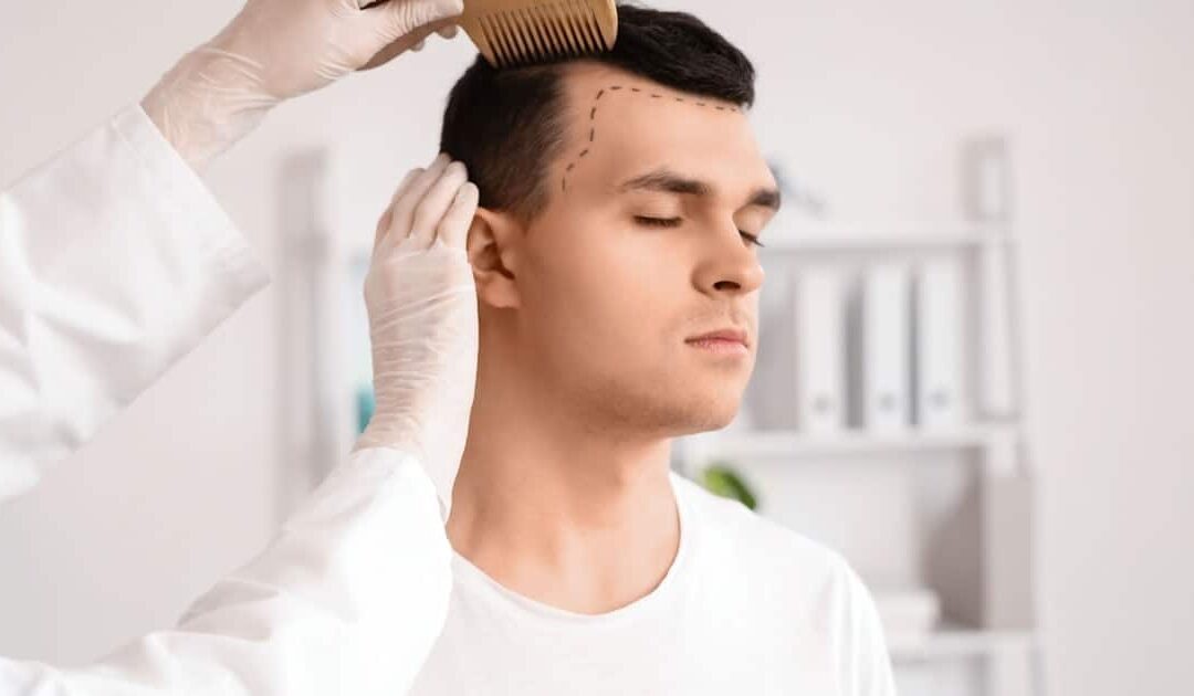 How to Choose the Best Hair Transplant: FUE vs. FUT