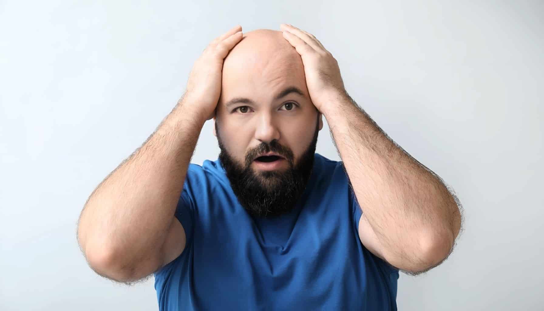 Failed Hair Transplant, man with thinning hair