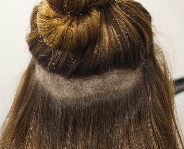 Long-Hair FUE, hidden shaved area for FUE for women's hair