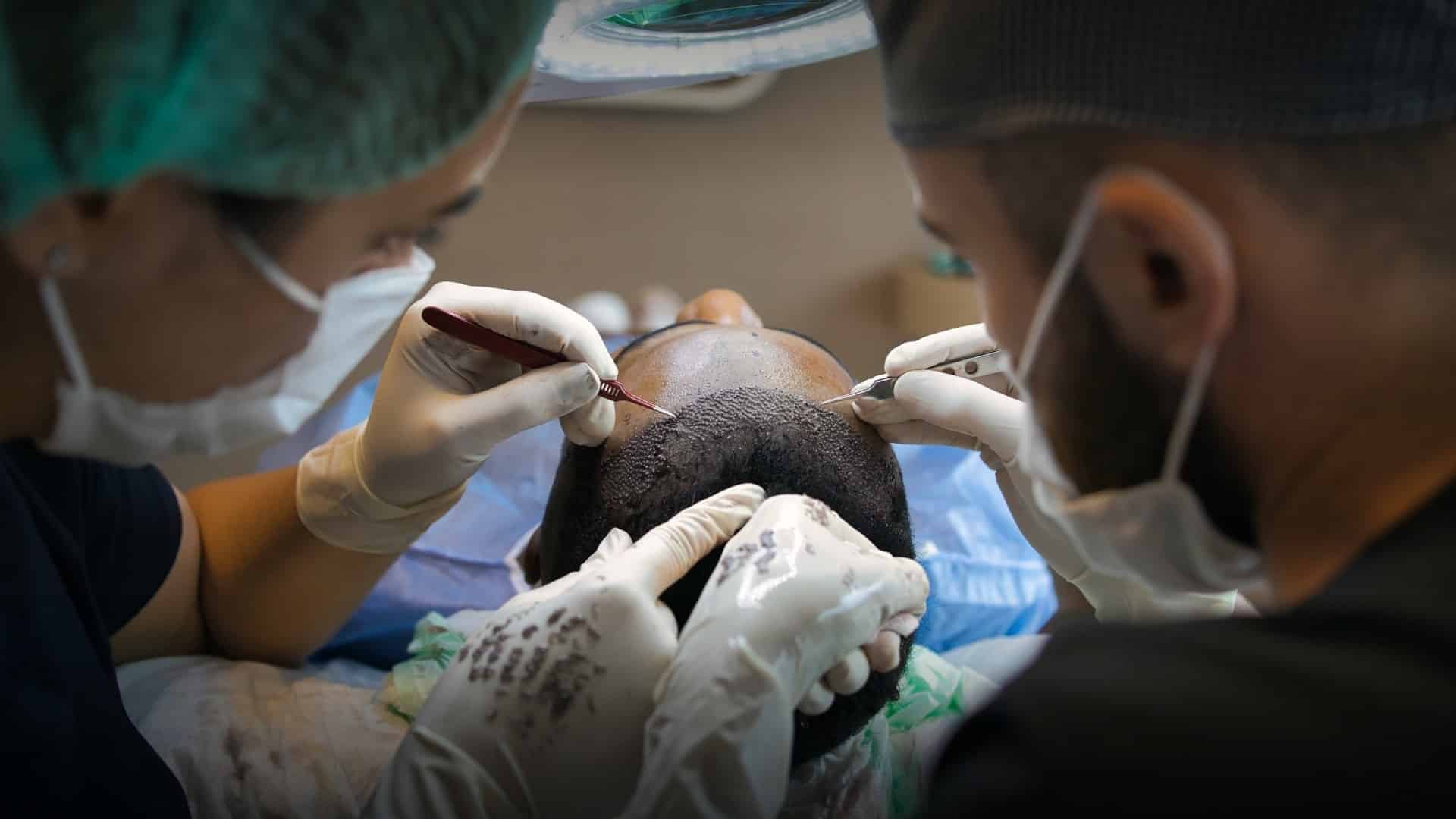 image of an African American hair transplant