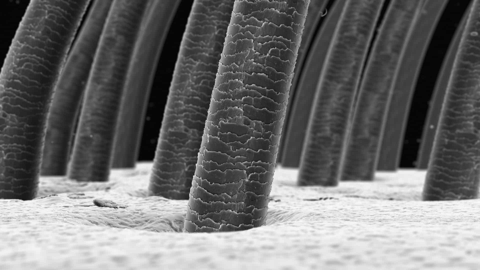 close up image of hair follicles that will be donor hairs for FUE