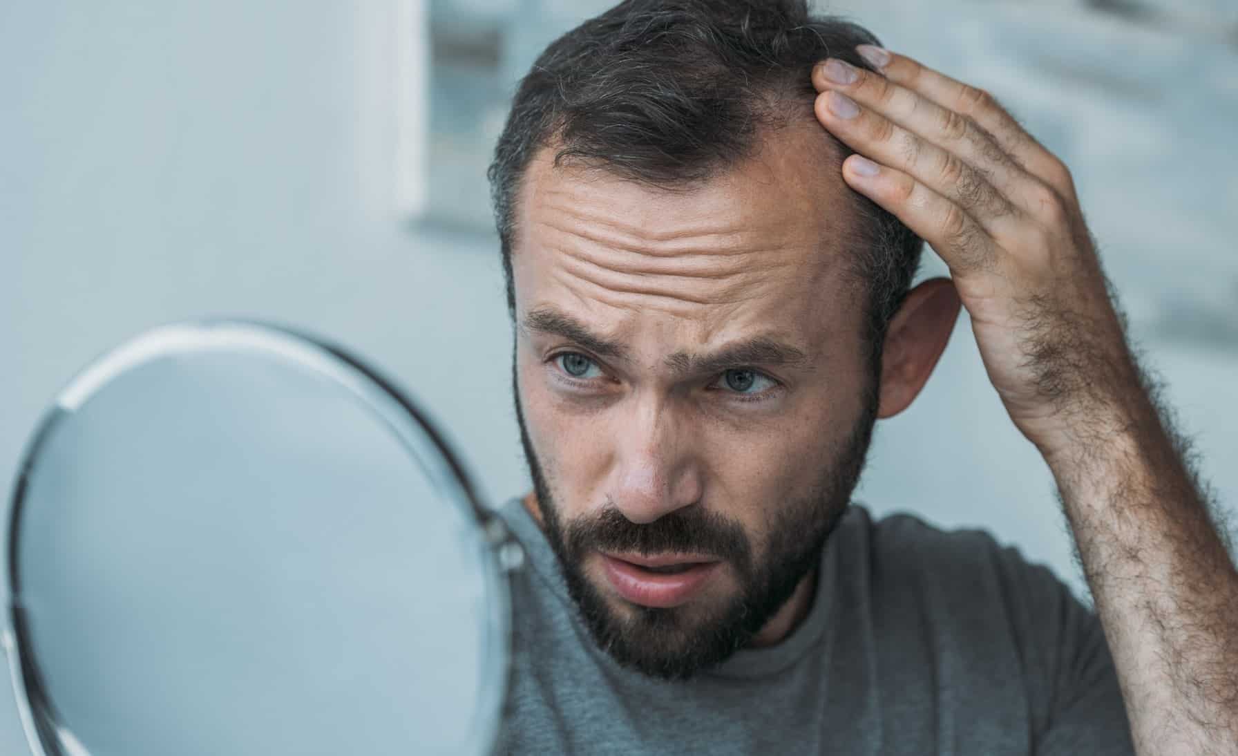 A young man examining his thinning hair in the mirror, looking concerned, with a bright bathroom background symbolizing early awareness of hair loss.