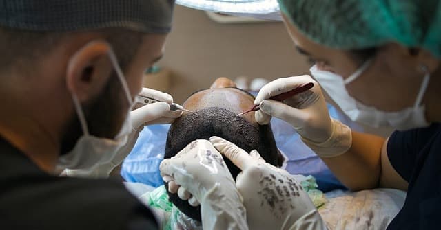 African American hair transplant, treatment, surgery