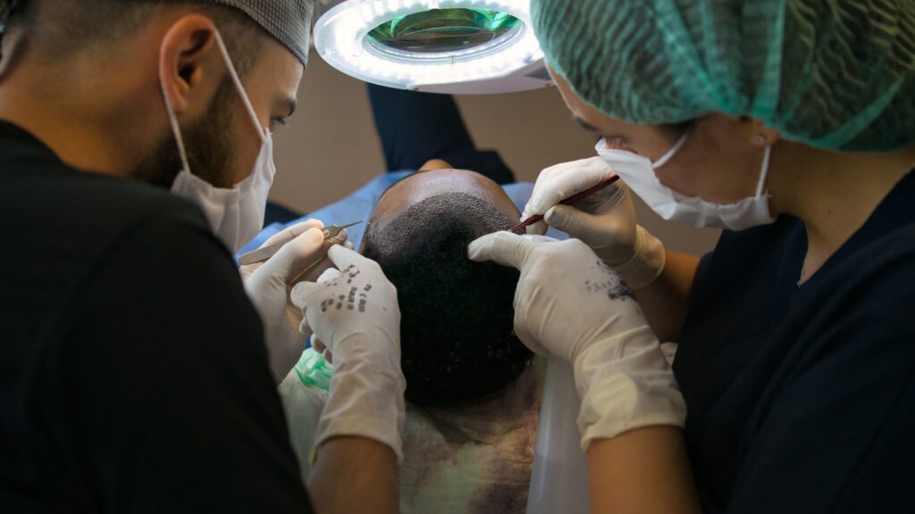 Image of an African American hair transplant