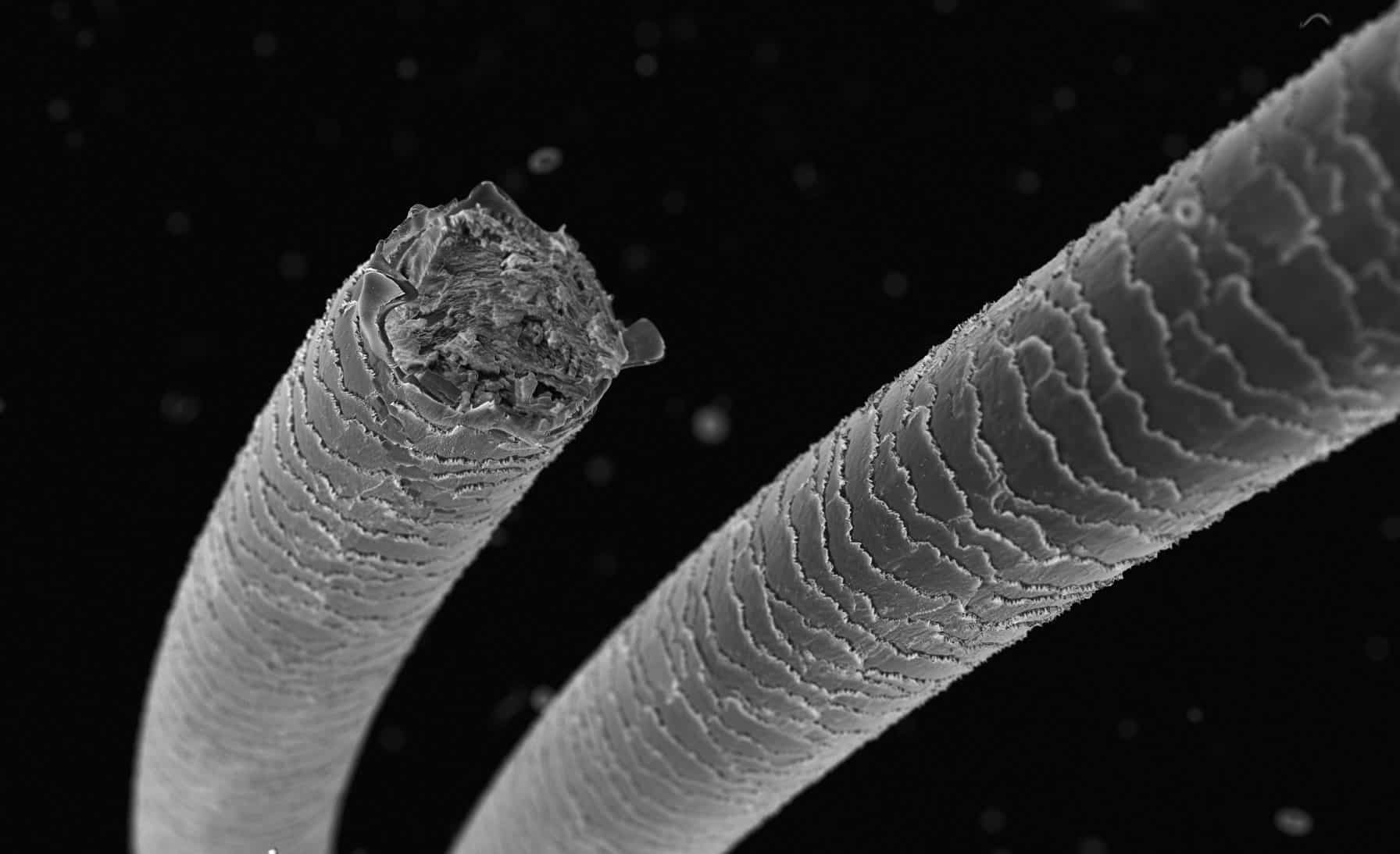 Illustration of hair follicles with stressed and broken hair under a microscope showing the effects of androgenetic alopecia, with labels pointing to thinning hair and DHT sensitivity.