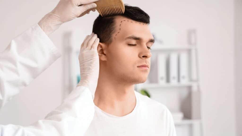 A hair transplant surgeon in the middle of a consultation with a patient