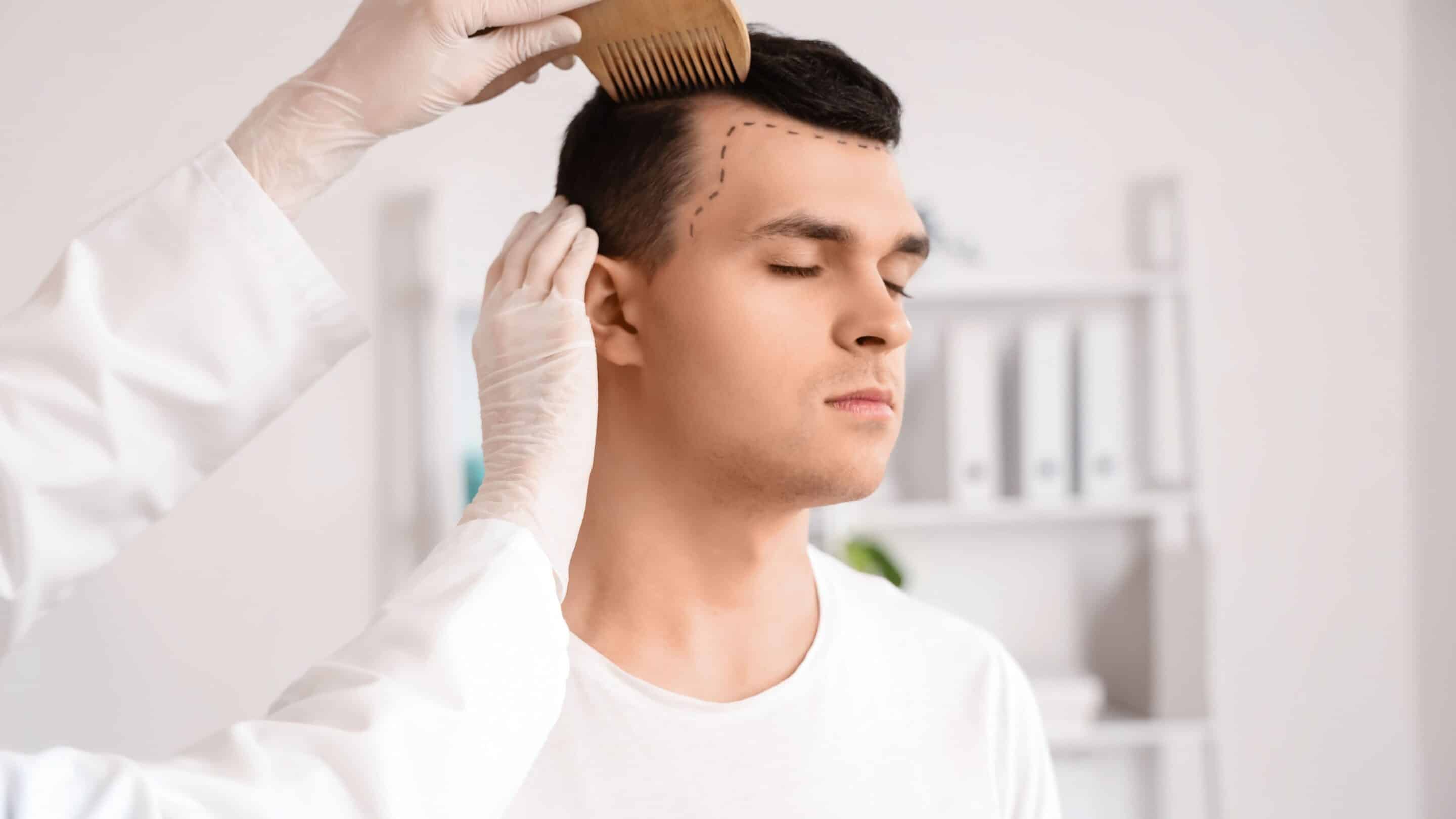 A hair transplant surgeon in the middle of a consultation with a patient